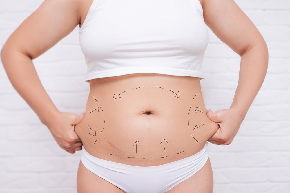 What Is Body Contouring and How Does It Work? | Vanity Compound